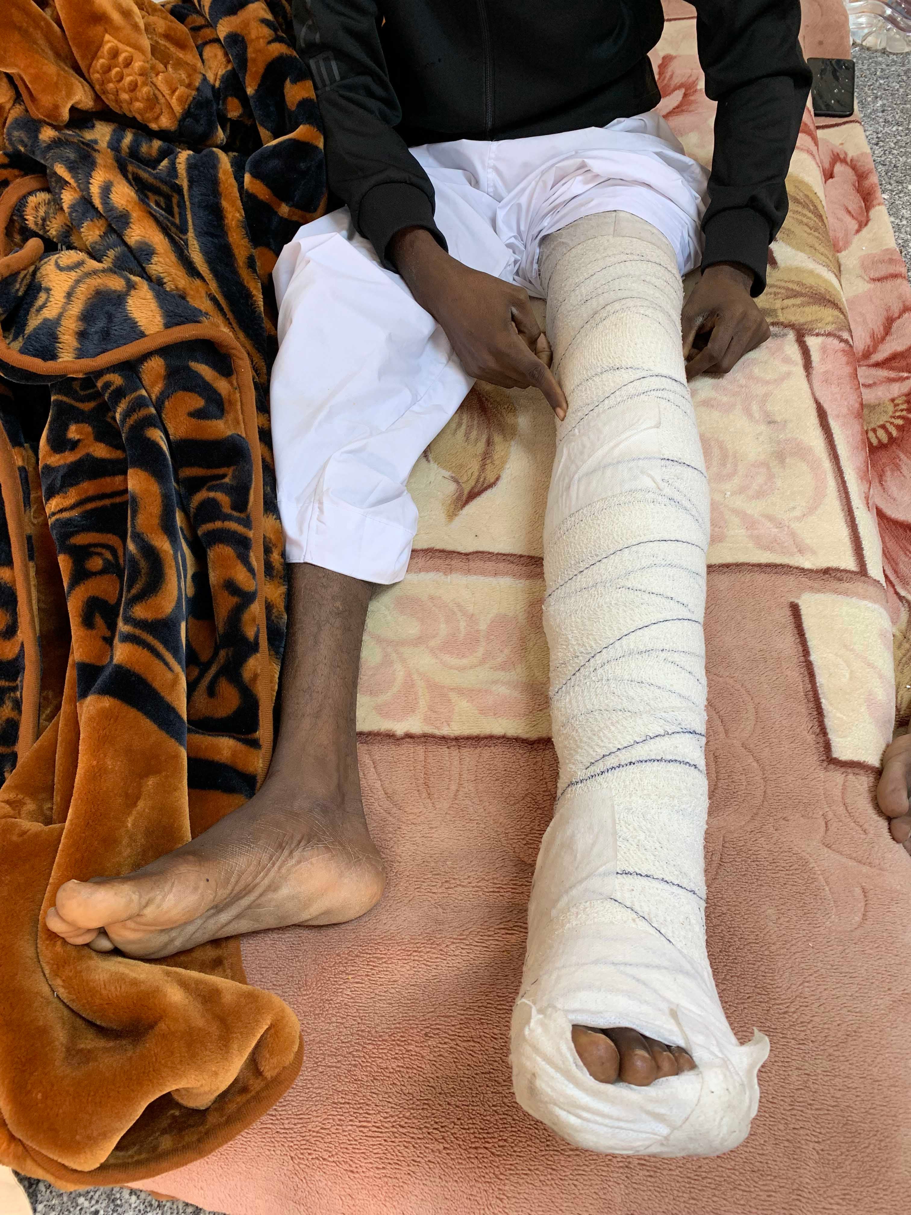 Factory worker recovering from knee injury after a UAE drone attack on a biscuit factory in Tripoli outskirts resulted in the killing of 8 civilians and injuring of 27 more; December 2019, Wadi Al-Rabie, Libya.