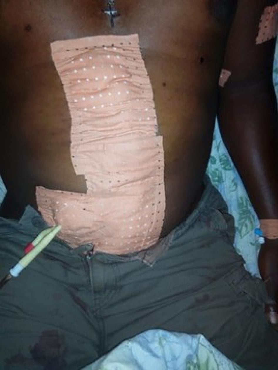 Close-up shot of bandages on a man's chest