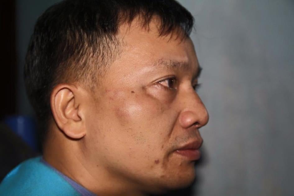 Nguyễn Văn Đài sau khi bị hành hung ở Nghệ An ngày mồng 6 tháng Mười hai năm 2015.