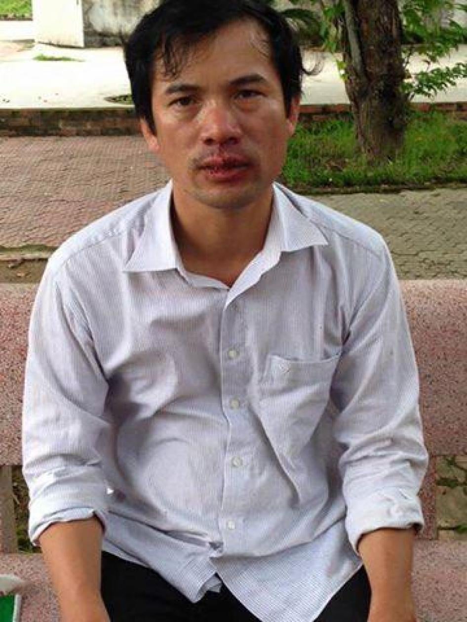 Nguyễn Năng Tĩnh sau khi bị hành hung ở Nghệ An ngày 24 tháng Mười một năm 2015.