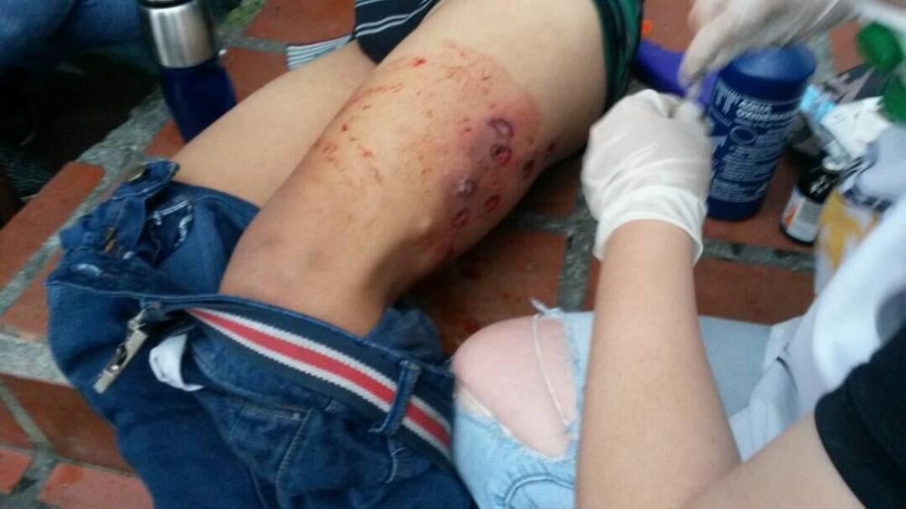Un manifestante herido por disparos con perdigones efectuados desde corta distancia durante una manifestación contra el gobierno en Mérida recibe atención médica de voluntarios de primeros auxilios, mayo de 2017. 