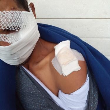 A migrant sustained severe head injury and a broken arm following a brutal beating by, what he stated was, six Croatian police officers during a pushback on October 16, 2020. 