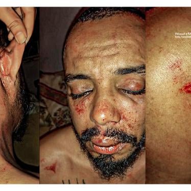 Badr Baabou, director of Damj Association for Justice and Equality, following his assault by suspected police officers in Tunisia. © 2021 Badr Baabou