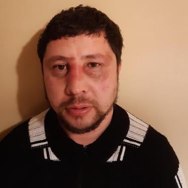 Ilhomjon Yakubov after the attack on March 16, 2020, Kaunas, Lithuania.