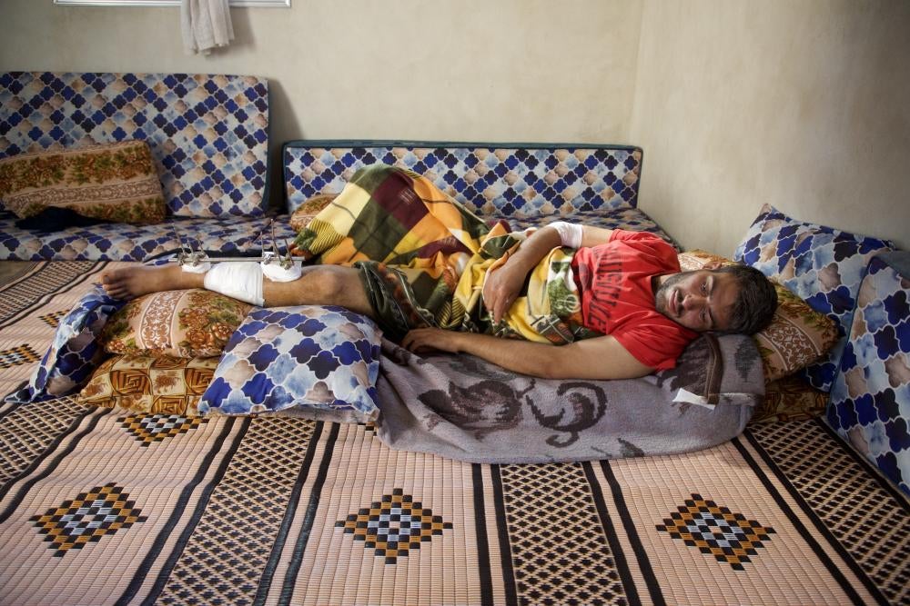 Mahm​​​​​​​oud Hammadi, uncle to the nine-year-old boy who accidentally picked up a dud submunition and dropped it just meters away from him in front of his house, lies on a mattress, his leg injured. His wife was also injured in the incidentattack, Termanin, Syria, October 14, 2023. 