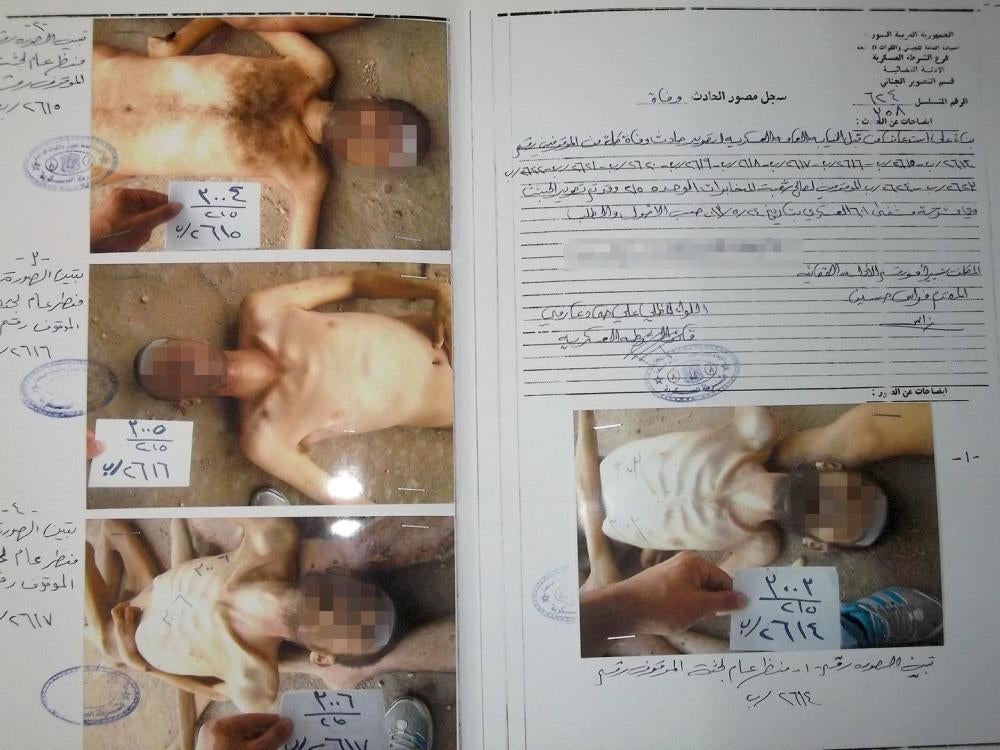 Syria Caesar photo: medical report