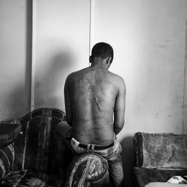 The scarred back of an Eritrean asylum seeker in Cairo who says Egyptian traffickers tortured him for ransom in Egypt’s Sinai peninsula by dripping molten plastic onto his back, May 2013.